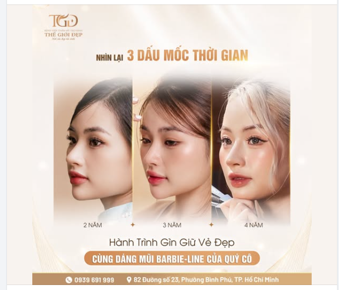 Nhìn lại 3 dấu mốc thời gian – Hành trình gìn giữ vẻ đẹp cùng dáng mũi Barbie-line của quý Cô