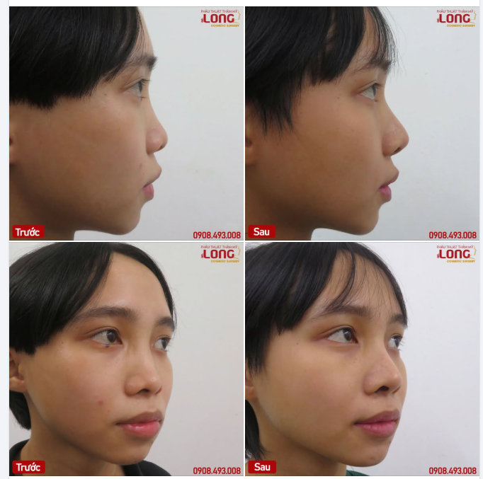 Đẹp lên không chỉ để hơn ai  Chỉ cần “ĐẸP” hơn theo cách riêng của bạn