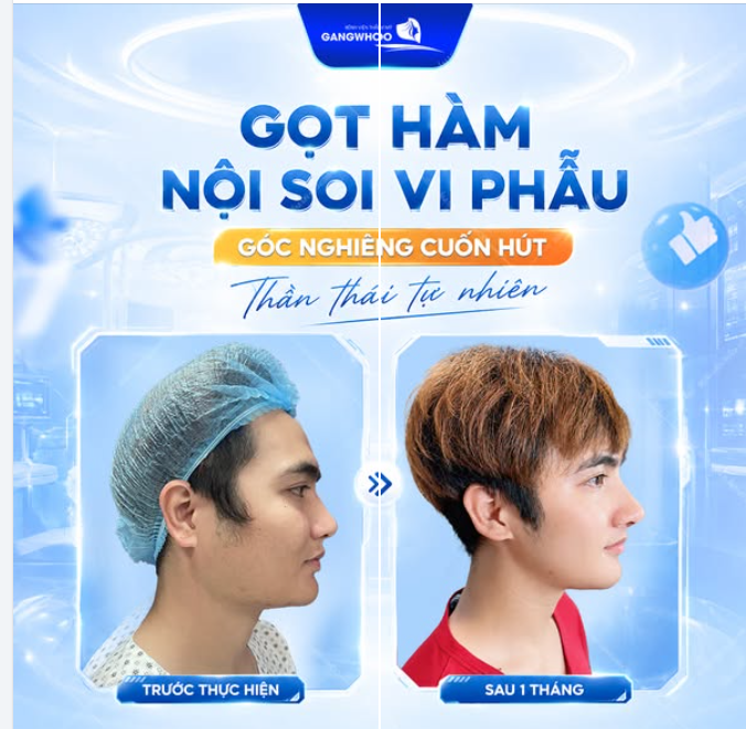 GÓC NGHIÊNG CUỐN HÚT THẦN THÁI TỰ TIN SAU GỌT HÀM NỘI SOI VI PHẪU