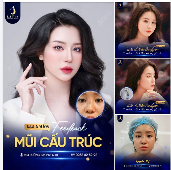 Một dáng m.ũi bền đẹp là khi thời gian đi qua, form mũi vẫn giữ được độ mềm, nét sang vẫn còn và thần thái kiêu sa vẫn hiện rõ trong từng góc nhìn.