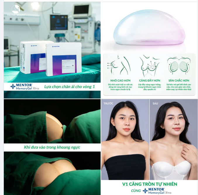 SỞ HỮU VÒNG 1 CĂNG TRÒN, MỀM MẠI CÙNG SIÊU PHẨM MENTOR XTRA