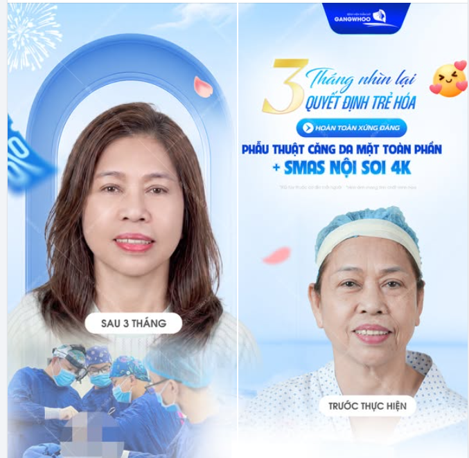 3 THÁNG NHÌN LẠI QUYẾT ĐỊNH TRẺ HÓA HOÀN TOÀN XỨNG ĐÁNG