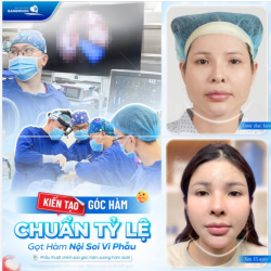 KIẾN TẠO GÓC HÀM CHUẨN TỶ LỆ - GỌT HÀM NỘI SOI VI PHẪU