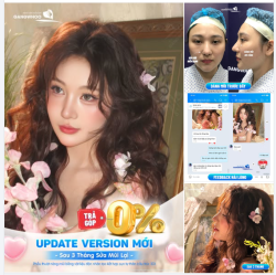 UPDATE VERSION MỚI SAU 3 THÁNG SỬA MŨI LẠI