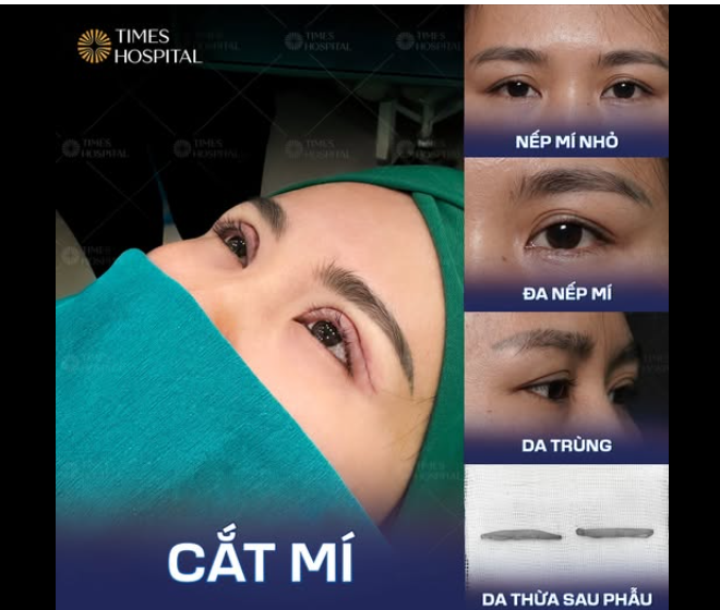 CẮT MÍ TỰ NHIÊN – GIỮ TRỌN NÉT ĐẸP RIÊNG CỦA BẠN