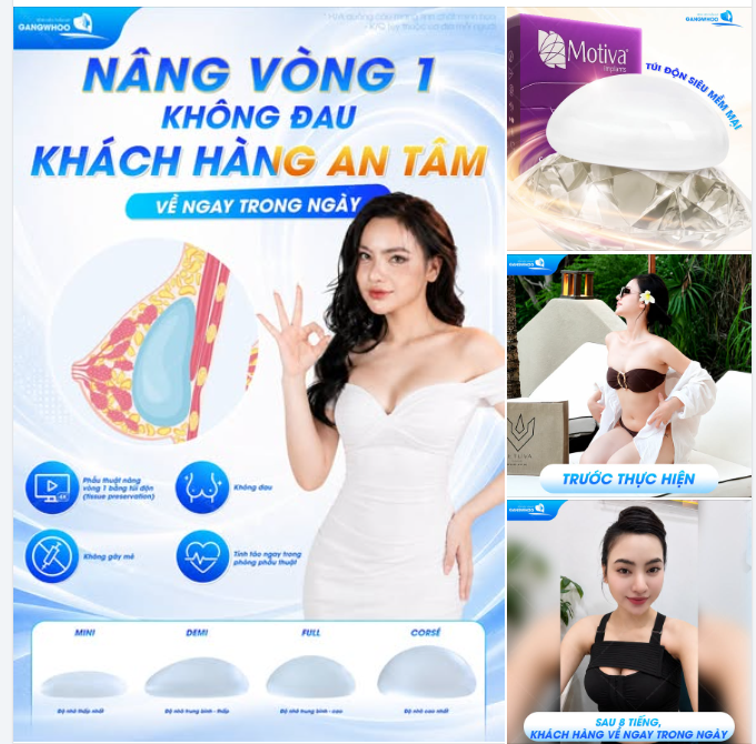 NÂNG VÒNG 1 KHÔNG ĐAU, KHÁCH HÀNG AN TÂM VỀ NGAY TRONG NGÀY