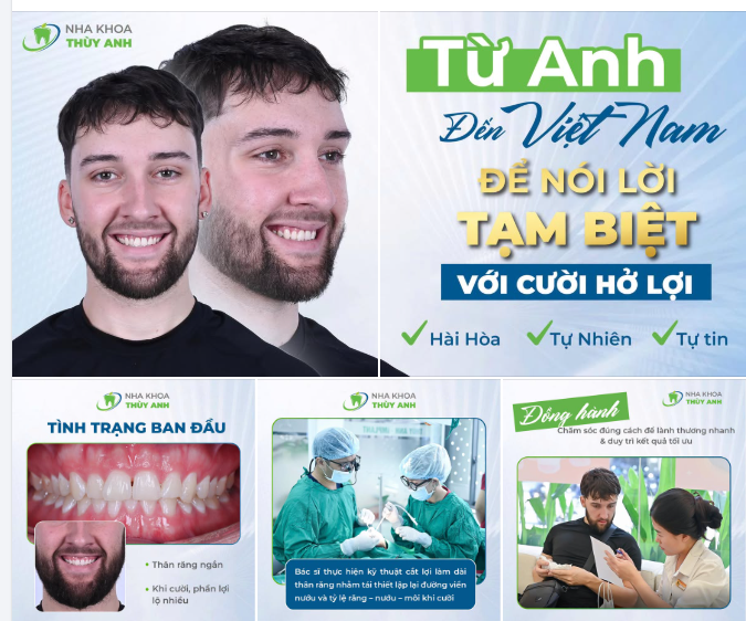 PHONG THÁI TỰ TIN KHI NỤ CƯỜI THỰC SỰ ĐƯỢC "CỞI MỞ"