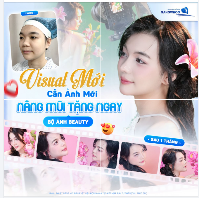 VISUAL MỚI - CẦN ẢNH MỚI