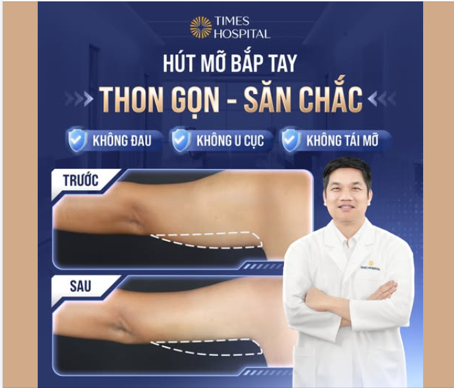 TẠM BIỆT BẮP TAY LỰC ĐIỀN – TỰ TIN DIỆN MỌI OUTFIT