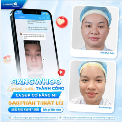 GANGWHOO GIẢI CỨU THÀNH CÔNG CA SỤP CƠ NÂNG MI
