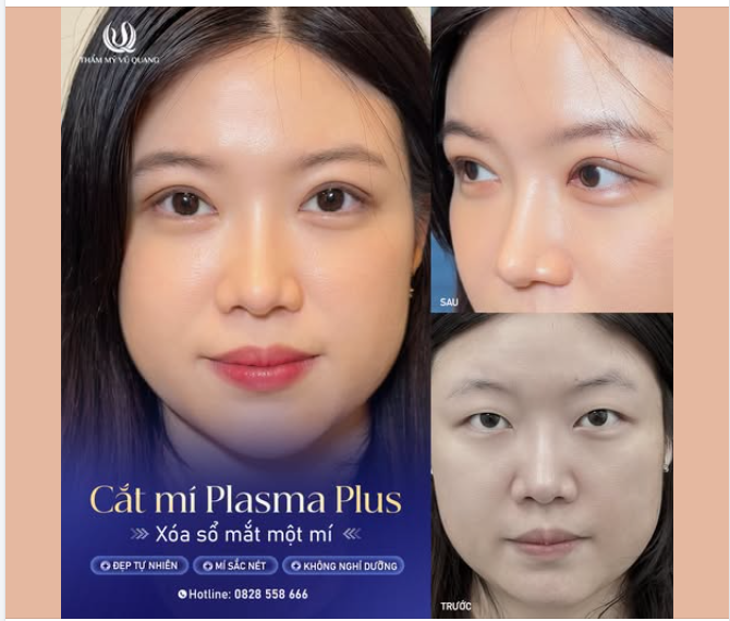 Ai bảo có đôi mắt đẹp hút hồn là khó? Chỉ với 15 phút trải nghiệm công nghệ Cắt mí Plasma Plus, bạn sẽ sở hữu ngay ánh nhìn quyến rũ, tự tin tỏa sáng mọi góc độ.