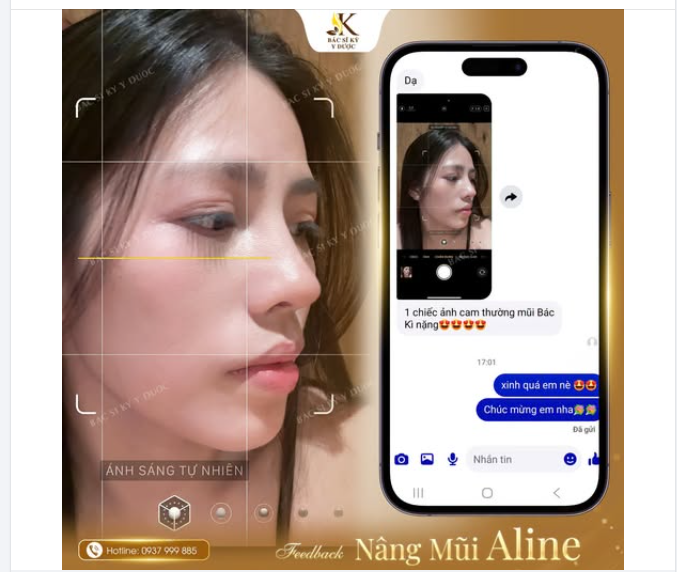 Không cần chỉnh góc,  Chỉ cần một dáng mũi hài hòa là đủ để mỗi lần mở camera đều thấy tự tin hơn.