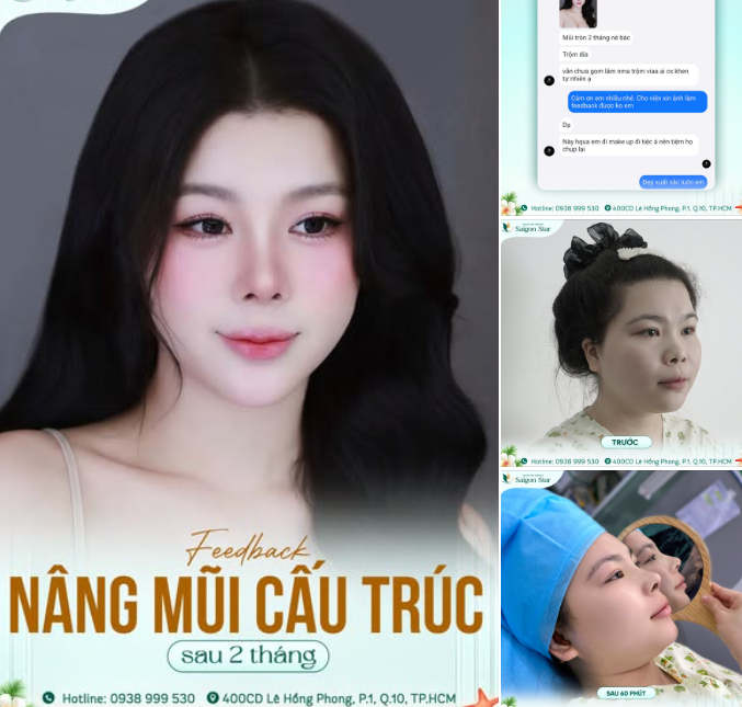 XEM FEEBACK LẤY ĐỘNG LỰC ĐI NÂNG MŨI THÔI CẢ NHÀ