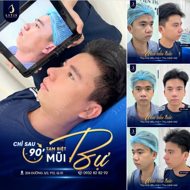 ĐẦU MŨI GỌN, CÁNH MŨI ÔM, GƯƠNG MẶT NAM TÍNH