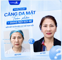 MỖI NẾP NHĂN ĐỀU CÓ THỂ THAY ĐỔI SAU 1 LẦN THỰC HIỆN