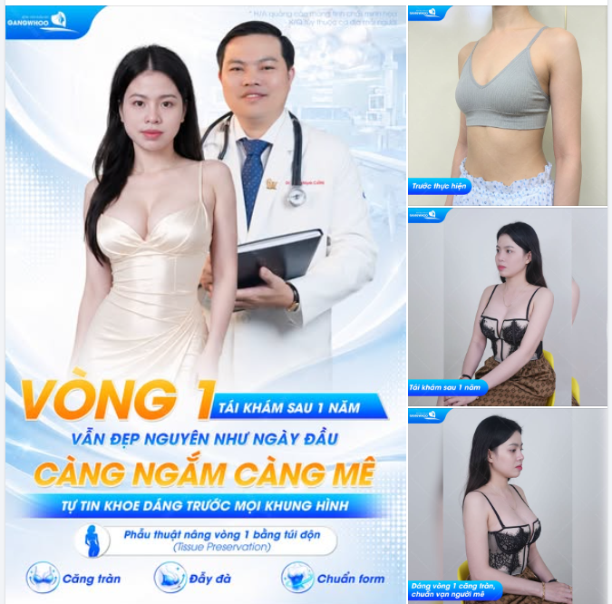 VÒNG 1 TÁI KHÁM SAU 1 NĂM VẪN ĐẸP NGUYÊN NHƯ NGÀY ĐẦU - CÀNG NGẮM CÀNG MÊ, TỰ TIN KHOE DÁNG TRƯỚC MỌI KHUNG HÌNH