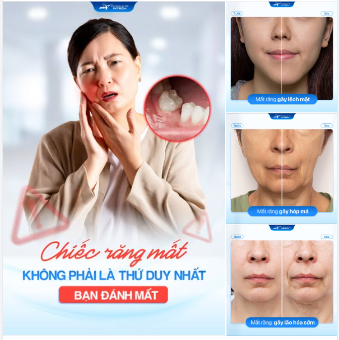 CHIẾC RĂNG MẤT KHÔNG PHẢI THỨ DUY NHẤT BẠN ĐÁNH MẤT