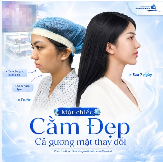 MỘT CHIẾC CẰM ĐẸP CHO NHAN SẮC THĂNG HẠNG