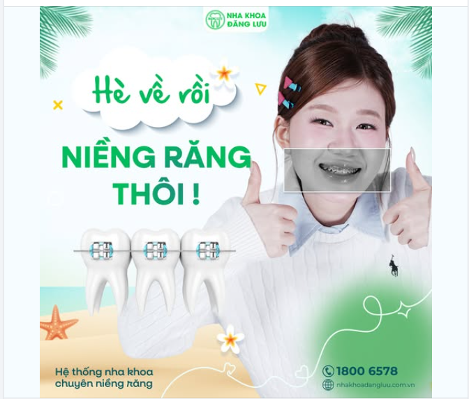 Mùa Hè - Mùa Của Niềng-er Chứ Còn Đâu Nữa!
