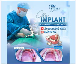 CẤY IMPLANT - CHẤM DỨT THÁNG NGÀY ĂN NHAI KHÓ KHĂN, MẤT TỰ TIN