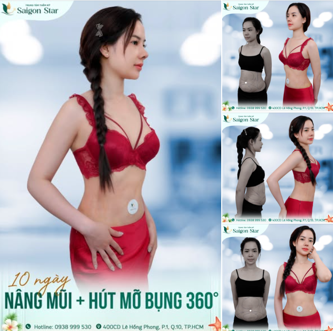 10 NGÀY LỘT XÁC HOÀN MỸ CÙNG DR. HOẠT