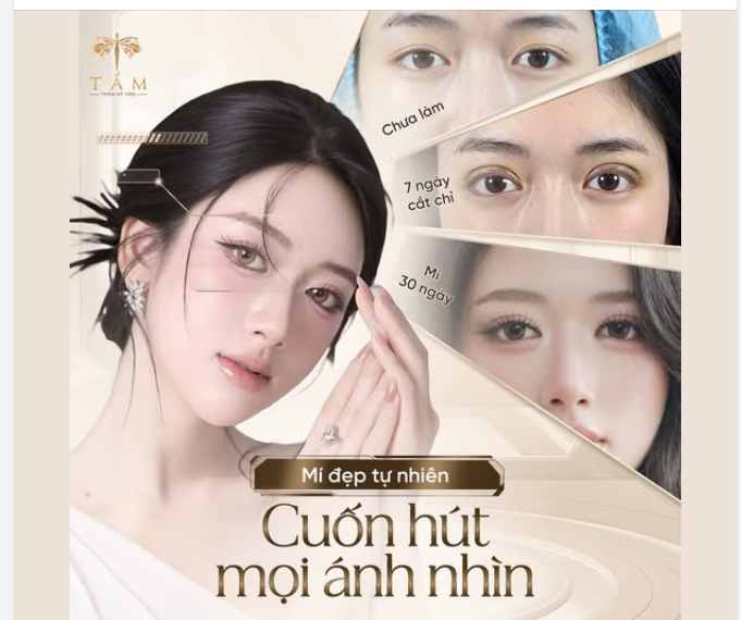 NẾP MÍ TỰ NHIÊN – CÂN ĐỐI MỌI ÁNH NHÌN