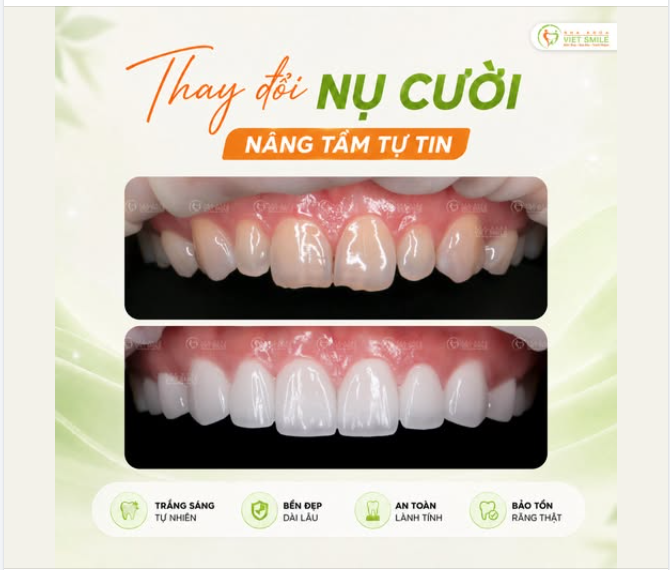 THAY ĐỔI NỤ CƯỜI – MỞ LỐI TỰ TIN