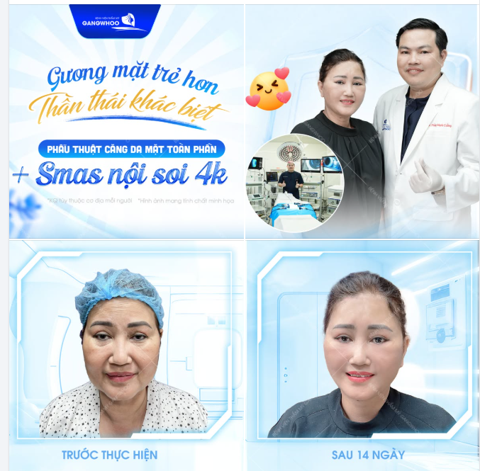 GƯƠNG MẶT TRẺ HƠN THẦN THÁI KHÁC BIỆT