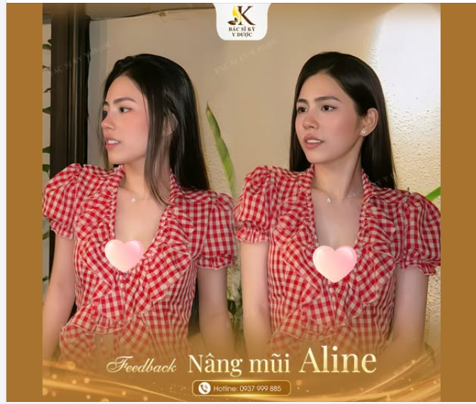 Mũi xinh một chút, nhan sắc tăng vút