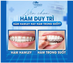 HÀM DUY TRÌ: NÊN CHỌN HÀM HAWLEY HAY HÀM TRONG SUỐT?