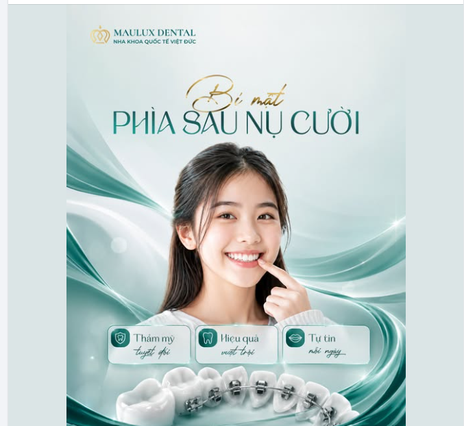 "BÍ MẬT SAU NỤ CƯỜI"  "Chị niềng răng lúc nào vậy? Em gặp chị suốt mà có thấy đâu!"
