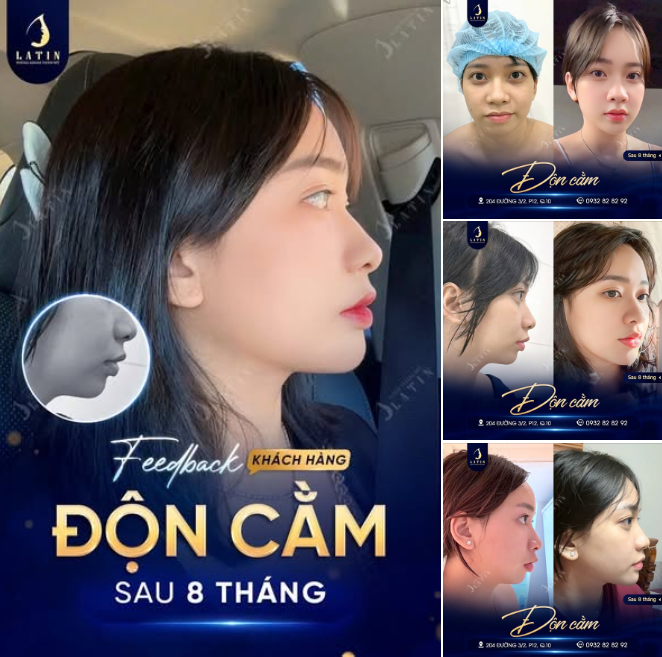 FEEDBACK ĐỌN CẰM SAU 8 THÁNG