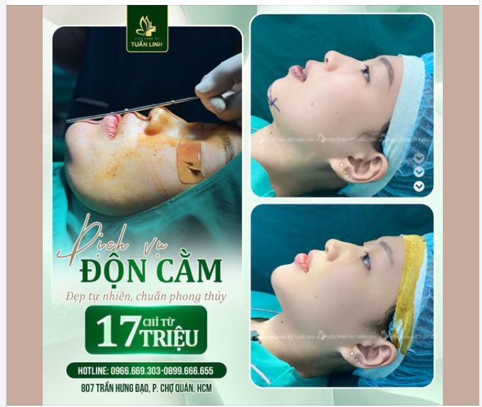 ĐỘN CẰM TỰ NHIÊN – CHUẨN TỶ LỆ, CHUẨN PHONG THỦY CHỈ TỪ 17 TRIỆU