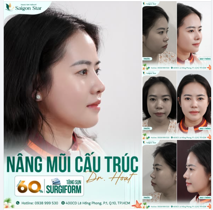 1 THÁNG THÔI MÀ... NHÌN CỨ TƯỞNG MỘT NGƯỜI KHÁC