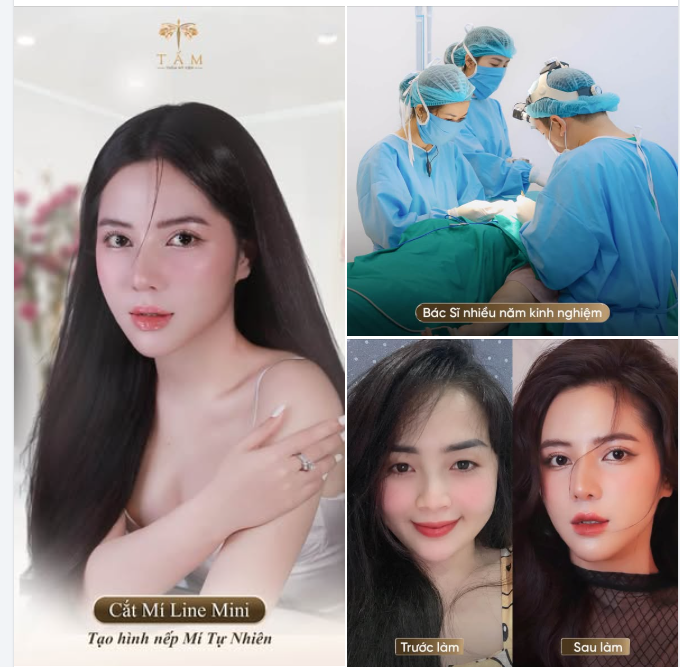 CẮT MÍ LINE MINI - TẠO NẾP MÍ RÕ NÉT, HÀI HÒA VỚI GƯƠNG MẶT