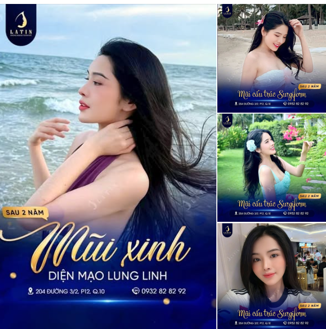 FEEDBACK MŨI CẤU TRÚC SAU 2 NĂM 