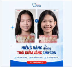 NIỀNG RĂNG ĐÚNG THỜI ĐIỂM VÀNG CHO CON – ĐẦU TƯ SỚM, LỢI ÍCH LÂU DÀI!