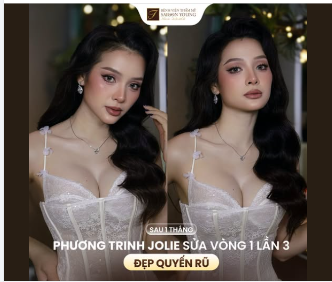 SẮC VÓC BÙNG NỔ CỦA PHƯƠNG TRINH JOLIE SAU 1 THÁNG NÂNG VÒNG 1
