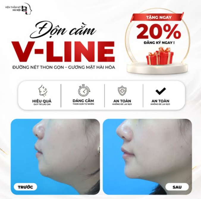 ĐỘN CẰM VLINE