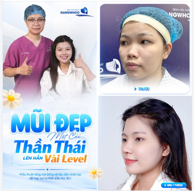 MŨI ĐẸP 1 CÁI - THẦN THÁI LÊN HẲN VÀI LEVEL