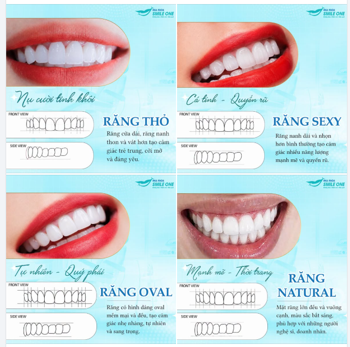 4 DÁNG RĂNG ĐƯỢC KHÁCH HÀNG SMILE ONE LỰA CHỌN NHIỀU NHẤT