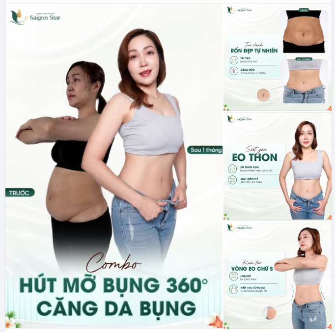 XUA TAN TỰ TI CÙNG COMBO: HÚT MỠ BỤNG 360˚ + CĂNG DA BỤNG