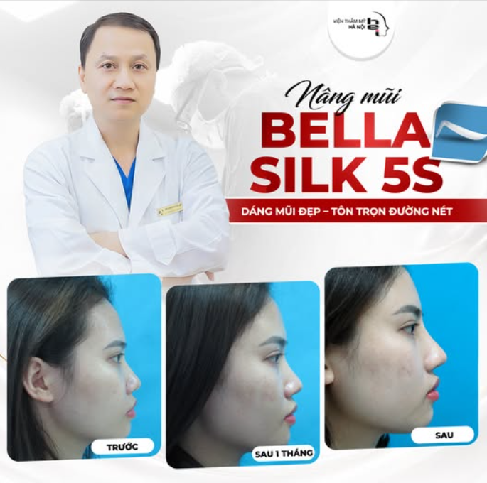 NÂNG MŨI BELLA SILK 5S