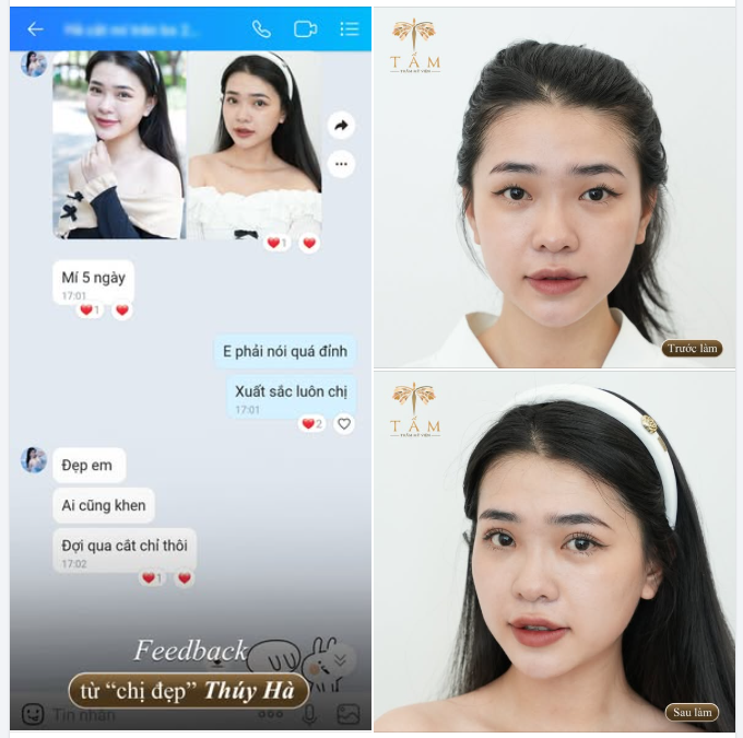 Feedback "ấm lòng" từ chị đẹp Thúy Hà khi nhận được "cơn mưa lời khen" cho nếp mí chỉ mới 5 ngày tuổi: