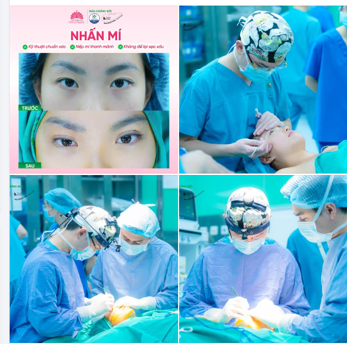 Không phải ai muốn sở hữu đôi mắt 2 mí cũng cần cắt mí