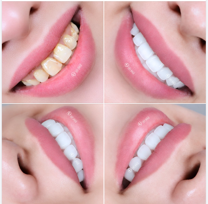 72 GIỜ LOẠI BỎ KHUYẾT ĐIỂM – ĐÓN NỤ CƯỜI TỎA SÁNG TỰ TIN