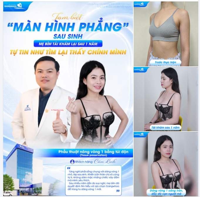 TẠM BIỆT “MÀN HÌNH PHẲNG” SAU SINH - MẸ BỈM TÁI KHÁM LẠI SAU 1 NĂM, TỰ TIN NHƯ TÌM LẠI THẤY CHÍNH MÌNH