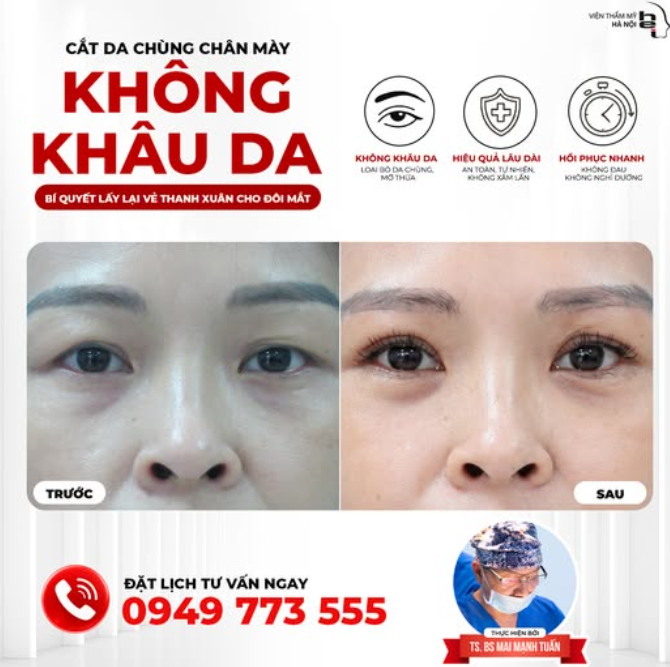 DA CHÙNG MÍ MẮT KHIẾN BẠN GIÀ HƠN TUỔI?