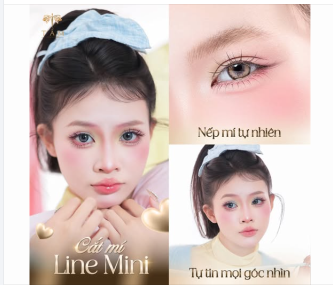 Cắt mí Line Mini – Bậc thầy kiến tạo đôi mắt hút hồn!