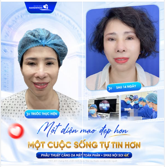 MỘT DIỆN MẠO ĐẸP HƠN, MỘT CUỘC SỐNG TỰ TIN HƠN